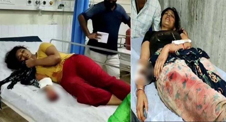 जालंधरः पालतू पिटबुल ने दो लड़कियों को किया घायल  