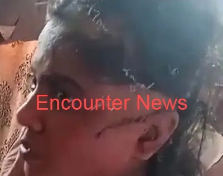 पंजाबः नशेड़ी पति ने पत्नी पर किया तेजधार हथियार से हमला, सिर पर लगे 90 टांके
