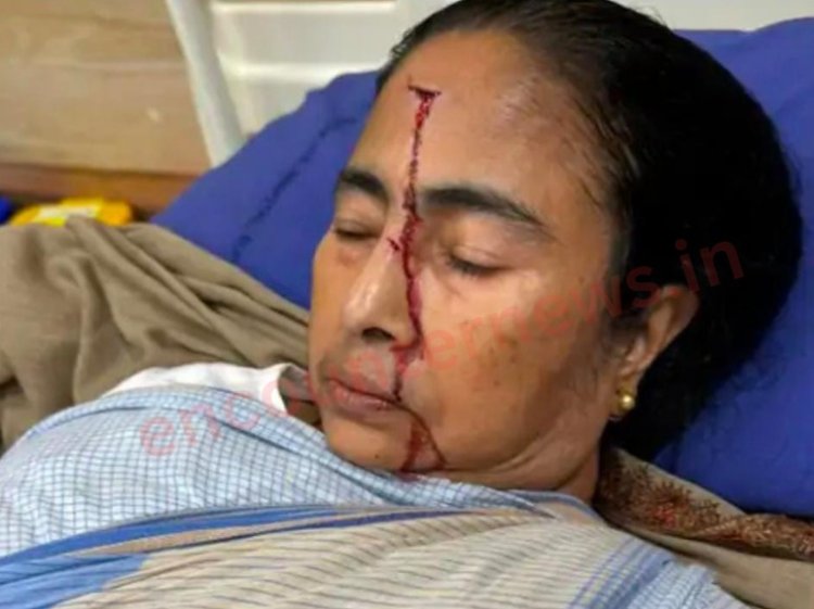 बड़ी खबर : CM ममता बनर्जी हुई घायल