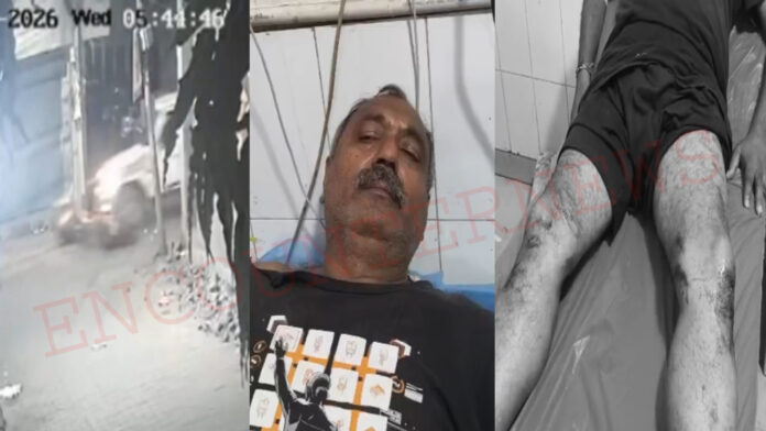 Punjab News: RSS शाखा जा रहे एक्टिवा सवार को गाड़ी ने मारी टक्कर, चालक घायल, देखें वीडियो